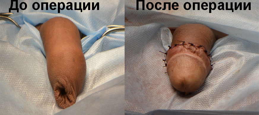 до и после операции.jpg